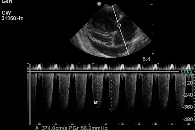 mitral valve insufficiency diagnostic by a dog or cat