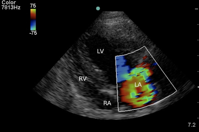 mitral valve disease diagnostic by a dog